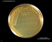 DCA agar